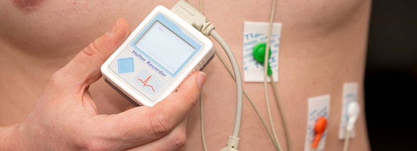 Hombre con holter de ritmo