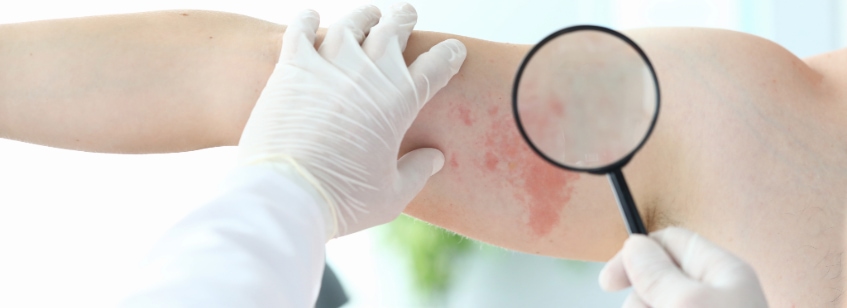 Efecto secundario de Scanner con contraste